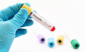 Chi tiết xét nghiệm Chlamydia và chi phí xét nghiệm Chlamydia